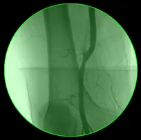 ../../../_images/regions_ecircleregion_example.webp